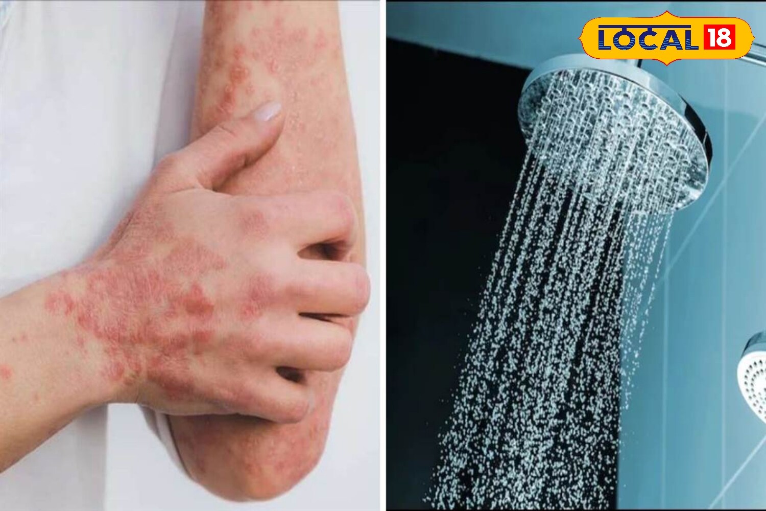 गर्म गर्म